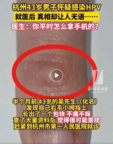 男子怀疑自己感染HPV，结果万万没想到…